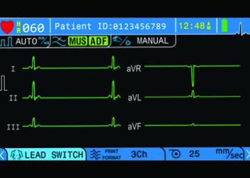 Color TFT Display